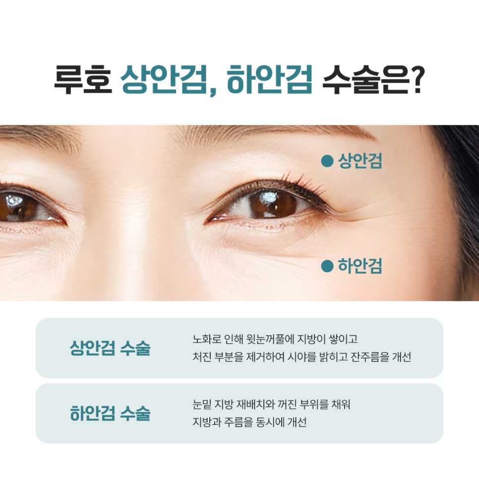 A Look at How Middle-Aged Eye Surgery at Sinsa Station Changes the Eye Shape image 2