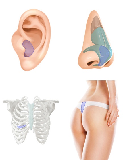 Apgujeong Station Low Nose Surgery: How to Naturally Increase the Bridge of the Nose image 5