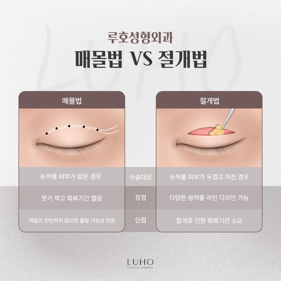 눈매에 또렷함에 집중한 신사역 쌍꺼풀 수술 결과 관련 이미지 3