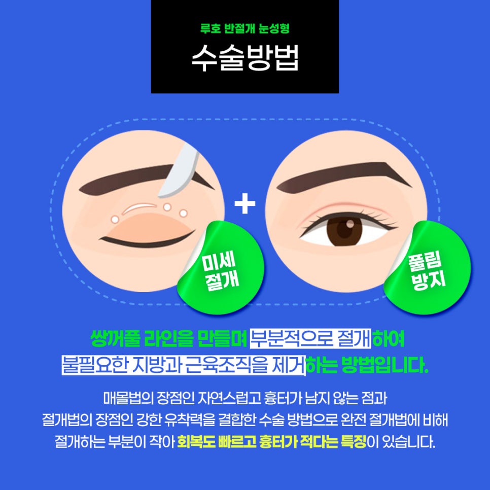［Luh Ho Plastic Surgery］Semi-Incision Eye Surgery image 3