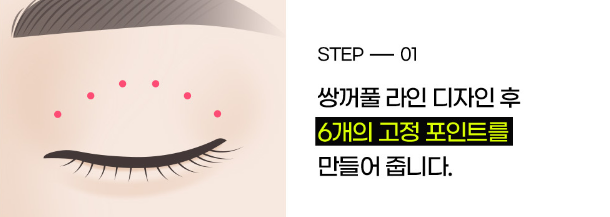 Ruho Plastic Surgery Natural Adhesion Eye Surgery image 3