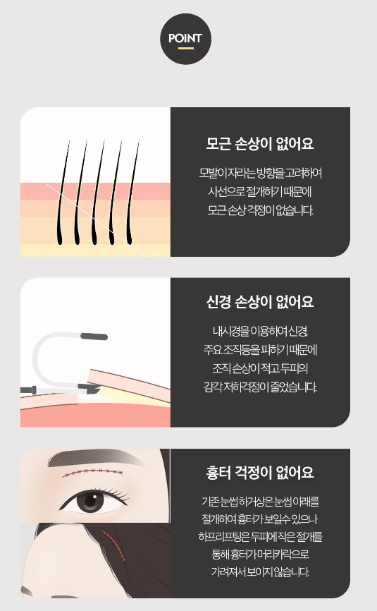［루호성형외과］🧓🏻중년부터 청년까지👨🏻 다~받는 엔도타인 이마거상 관련 이미지 12