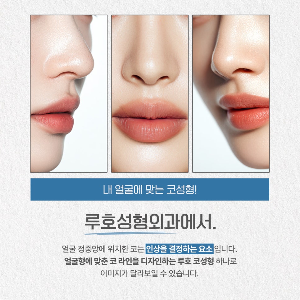 얼굴과의 조화를 맞춘 코성형, 전후 변화 살펴보기 관련 이미지 2