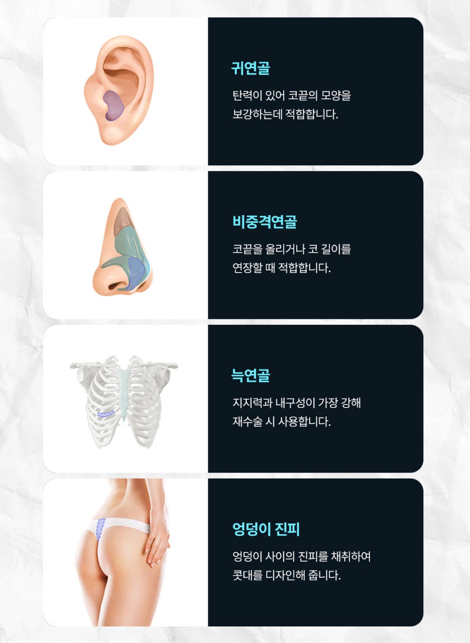 높이보다 조화를 만든 신사역 남자코수술 병원 후기 관련 이미지 4