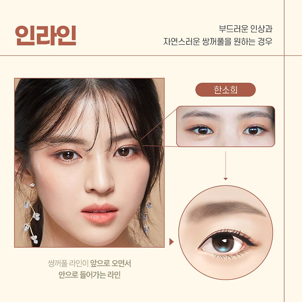 ［루호성형외과］2023년 인기있는 여자 연예인 눈 관련 이미지 3