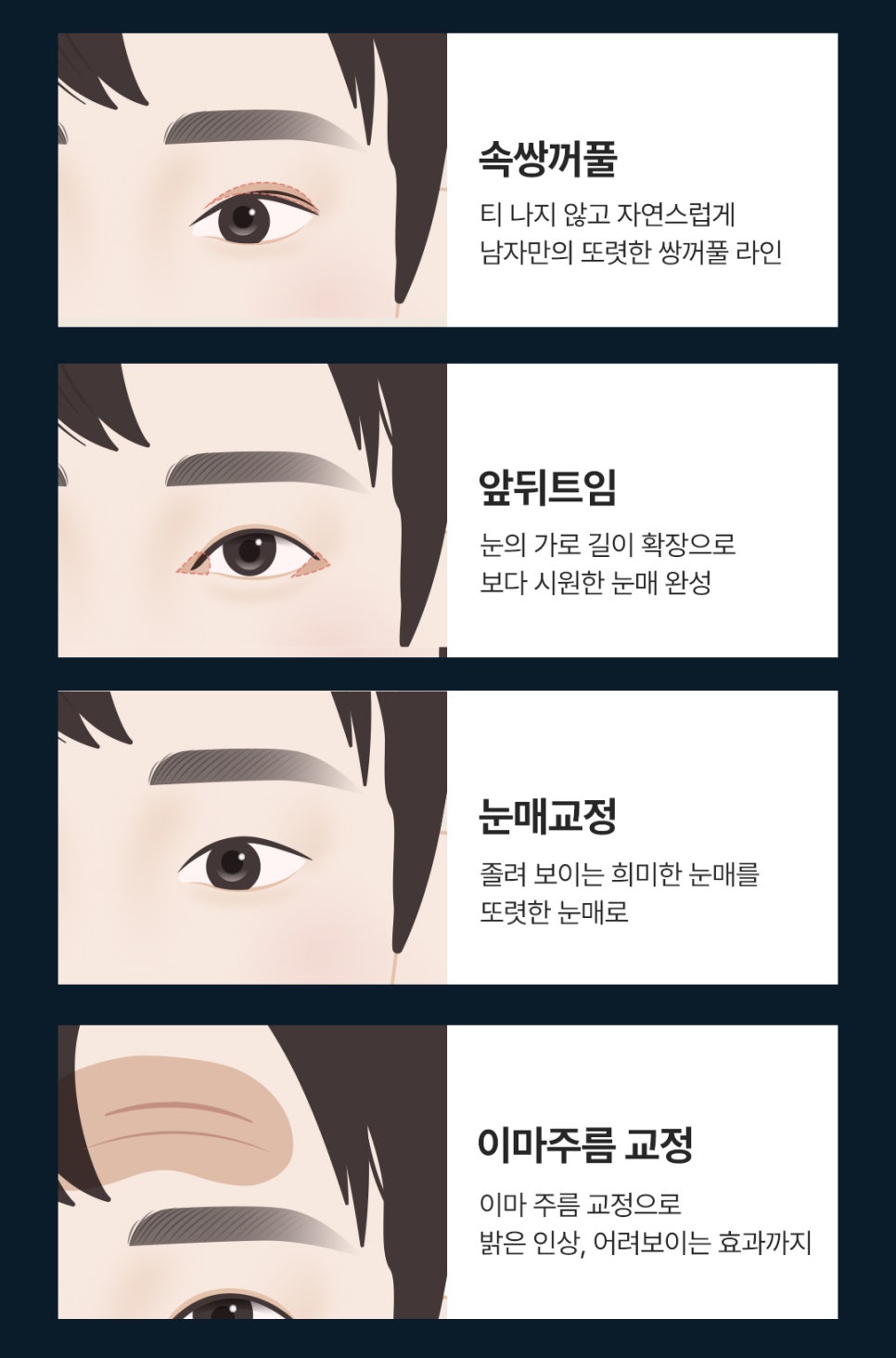 Before and After Male Eye Surgery at Sinsa Station That Created a Positive Impression image 4