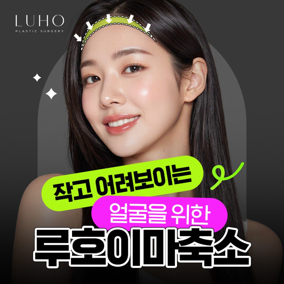 이마축소수술 전후사진 비교｜자연스러운 헤어라인 교정 후기 관련 이미지 1