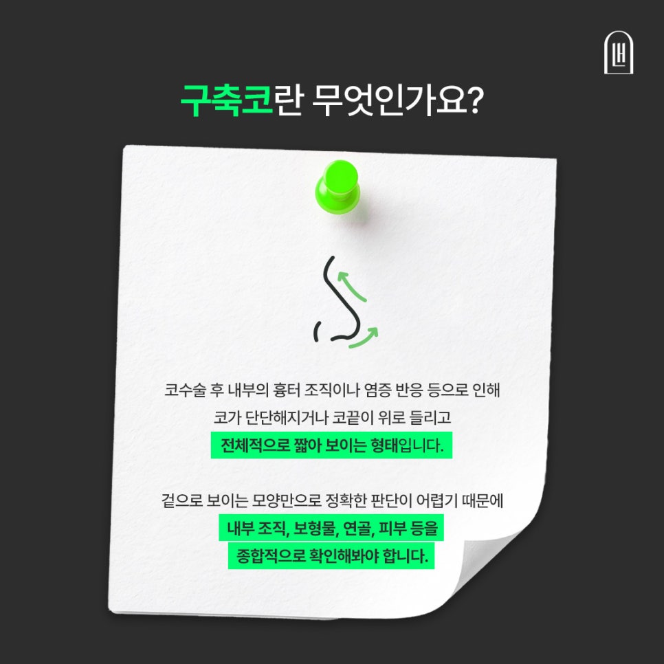 구축코 재수술, 원인부터 후기까지 한눈에 알아보기 관련 이미지 2