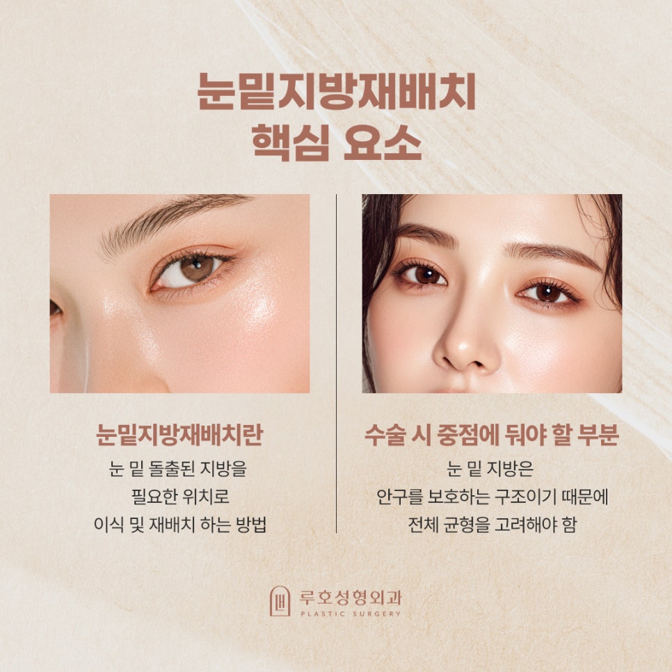 신사역 눈밑지 후기로 눈 밑 인상 변화 포인트 살펴보기 관련 이미지 4