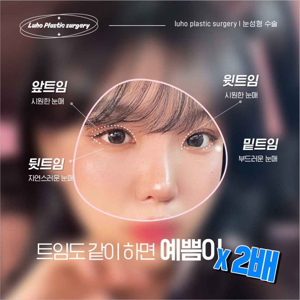Ruho Plastic Surgery Natural Adhesion Eye Surgery image 6