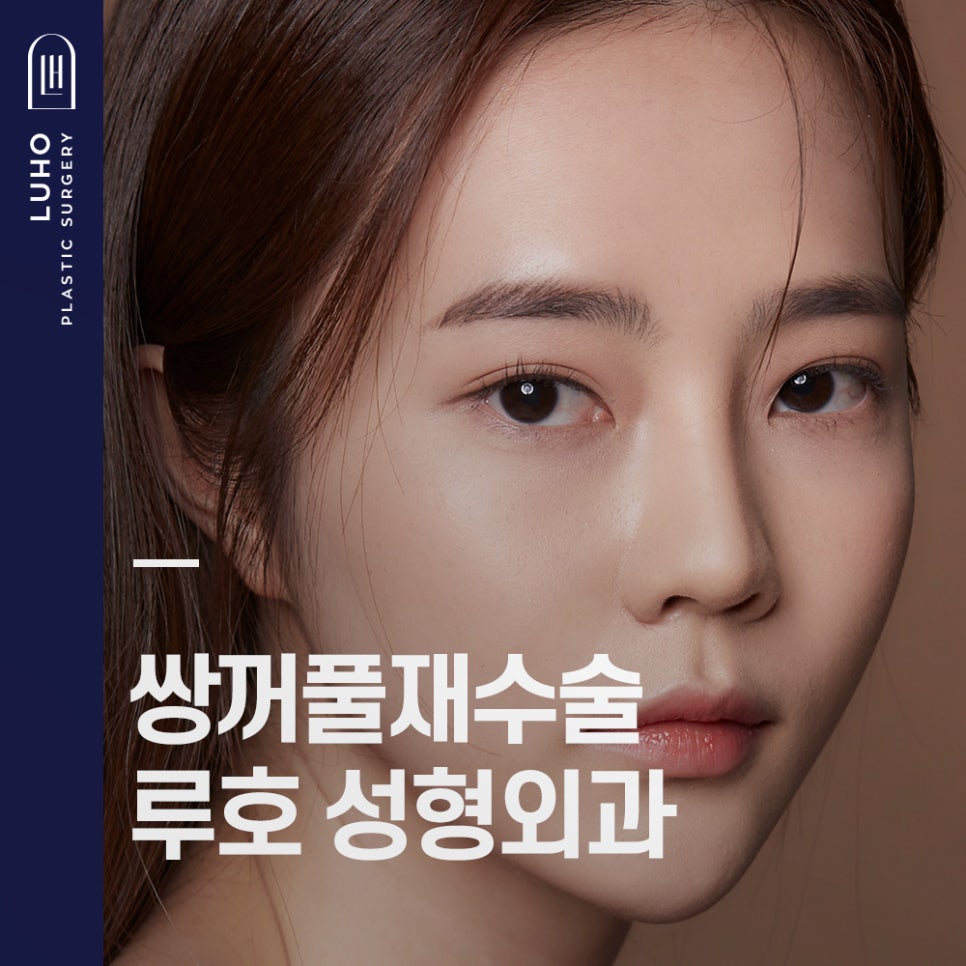 Double Eyelid Revision Surgery — Let’s Finish It at Luho! image 1