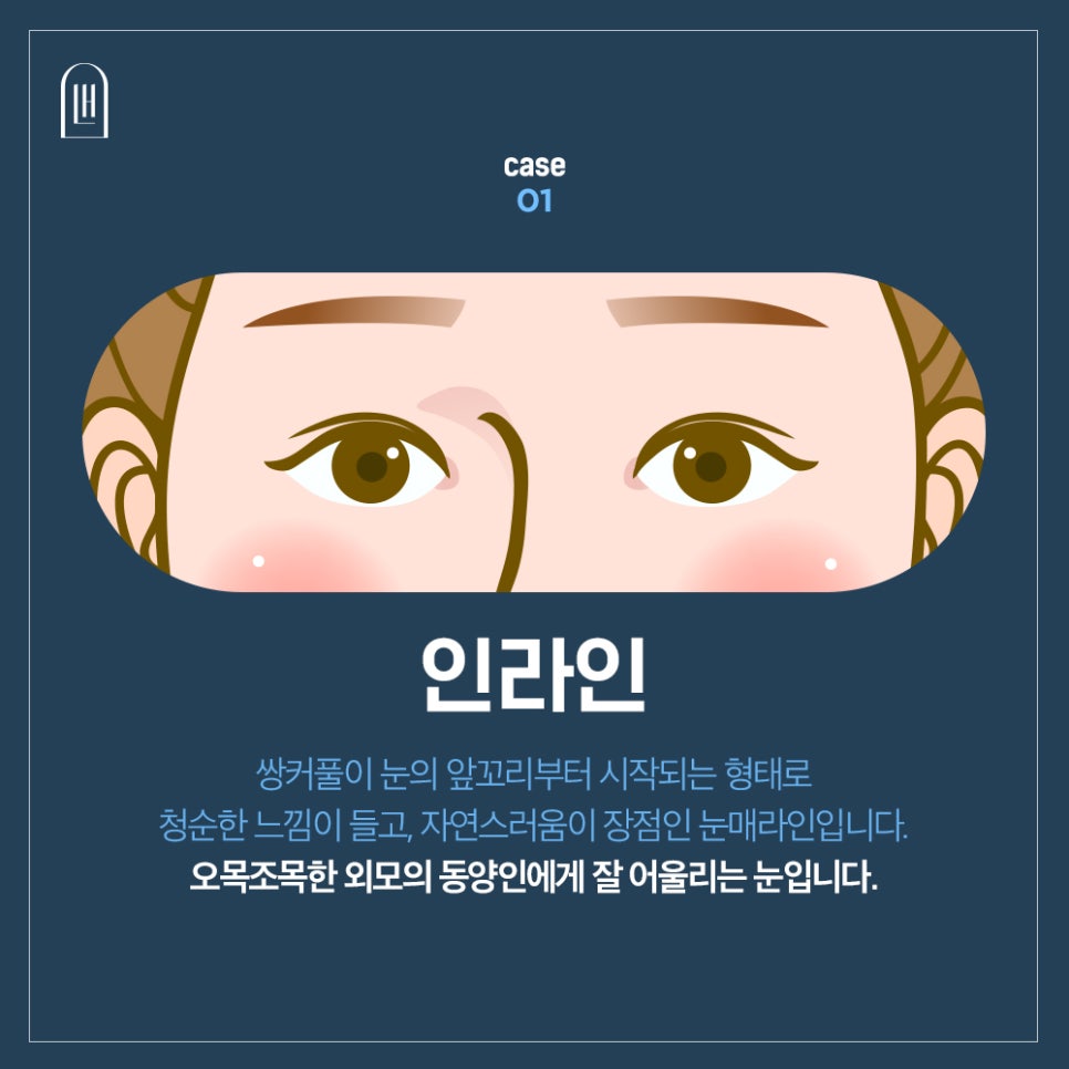 자연스러운 쌍수 인라인쌍커풀 하려면 관련 이미지 3