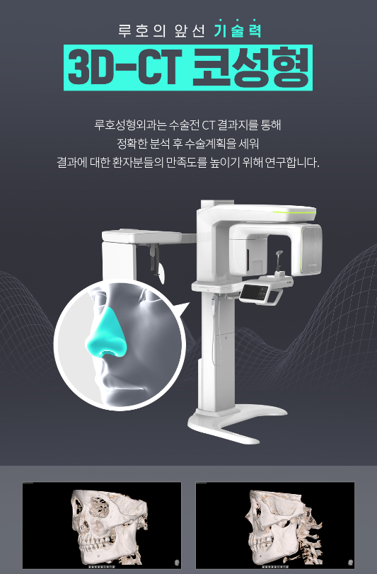 [Luho Plastic Surgery] Luho’s First Nose Surgery image 7