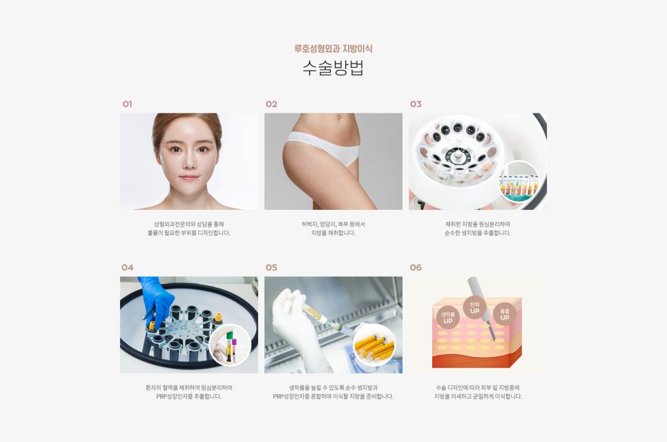 루호의 생지방 지방이식 관련 이미지 4