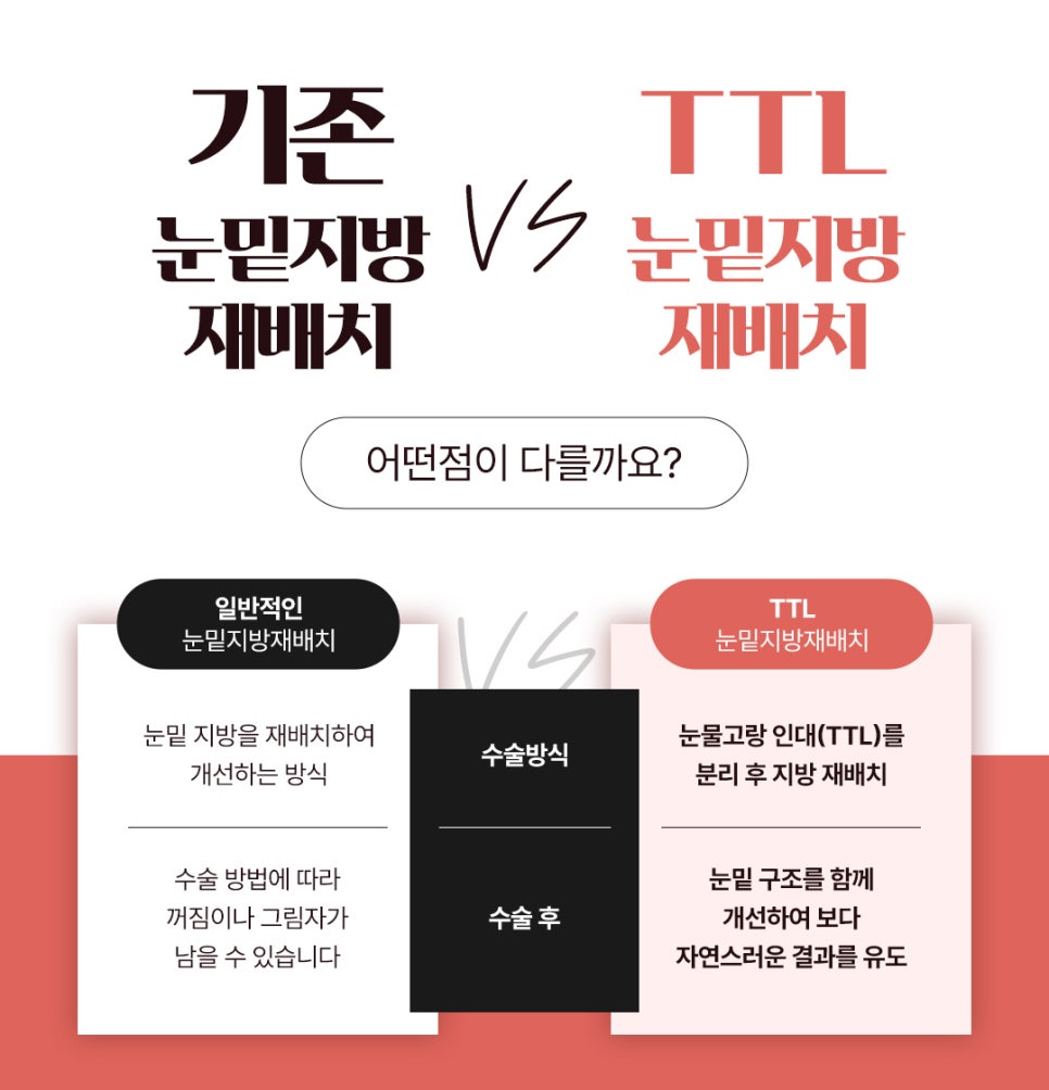 구조의 문제로 인한 다크서클, 환하게 바꾼 남성눈밑지후기 관련 이미지 2