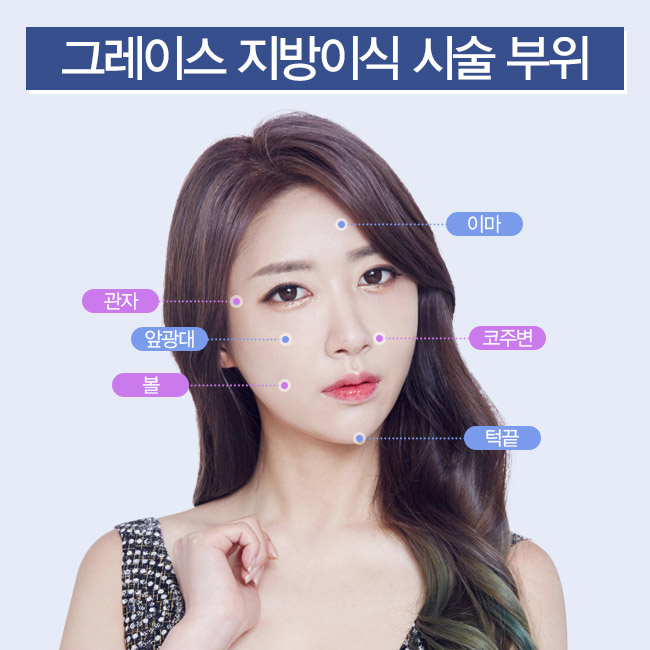 얼굴지방이식을 알아본다면? 신사역 그레이스성형외과 관련 이미지 5