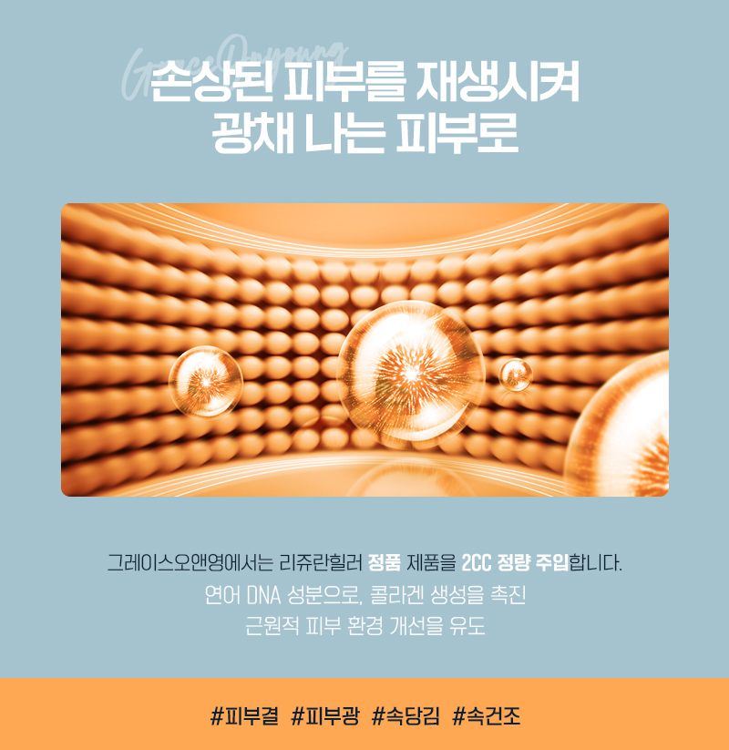리쥬란힐러가격 <잠원동피부과 그레이스오앤영> 관련 이미지 2