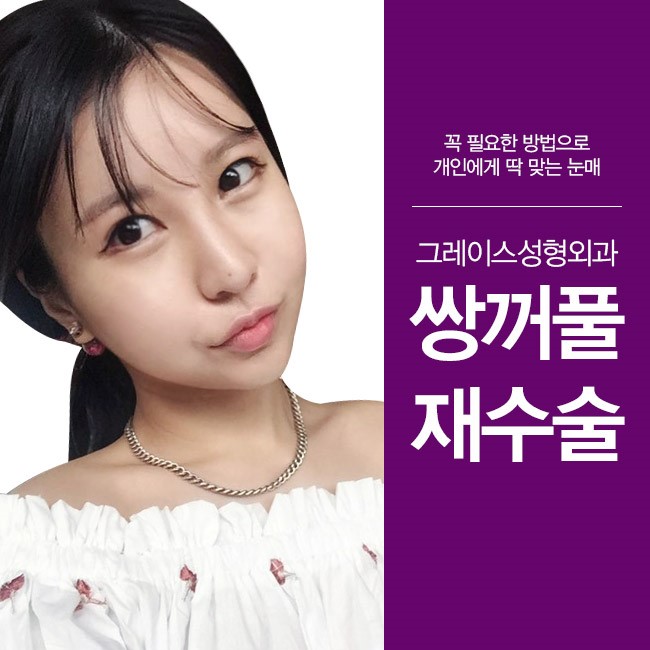 나에게 꼭 필요한 방법으로 그레이스성형외과 쌍꺼풀재수술 관련 이미지 4