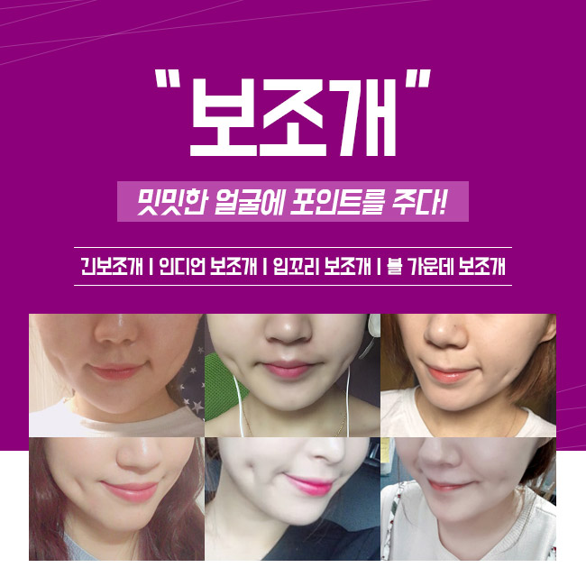 이미지 변신은 그레이스성형외과 보조개 수술 관련 이미지 1
