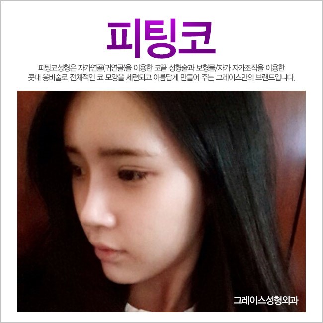 얼굴의 전체적인 밸런스를 고려한 그레이스성형외과 피팅코 관련 이미지 1