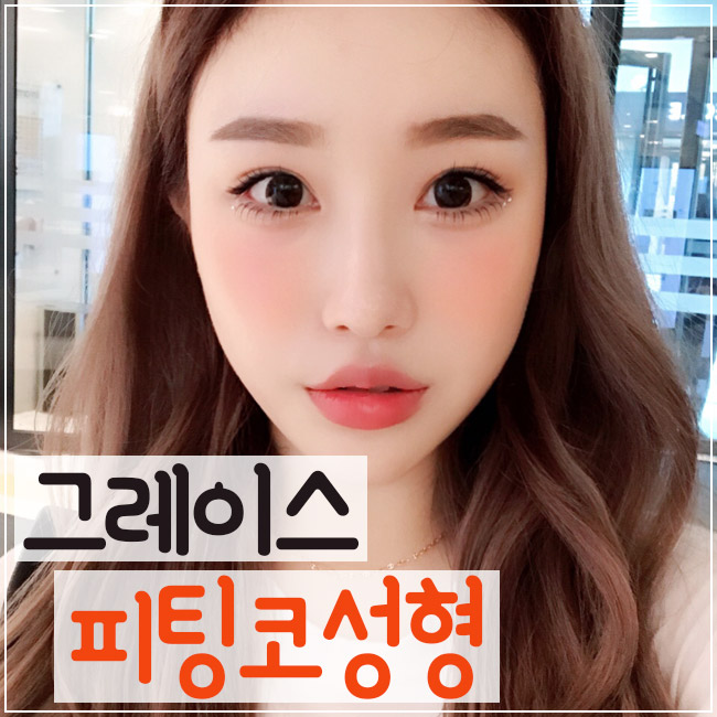 그레이스성형외과 최문섭원장님과 김윤호원장님이 집도하는 피팅코성형 관련 이미지 1