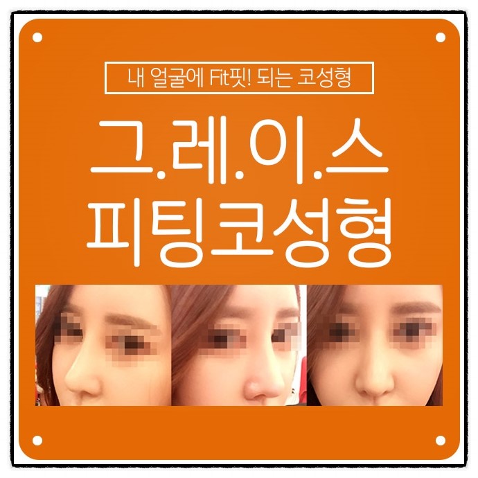 코성형비용 부담없고 합리적인 가격으로 관련 이미지 2