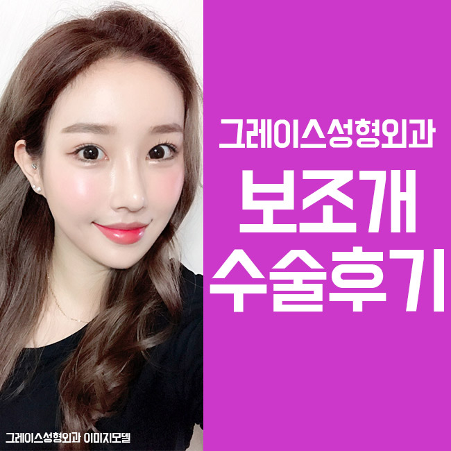 예쁜 보조개수술후기 만족스러워 관련 이미지 1