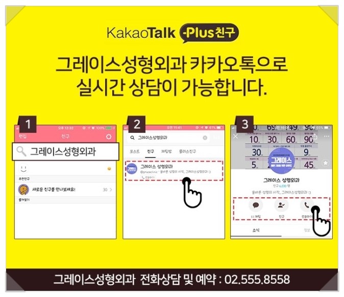 눈 밑 처짐 해결, 하안검수술후기 관련 이미지 7