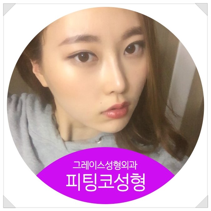 코성형의 혁명, 그레이스성형외과 피팅코 관련 이미지 3