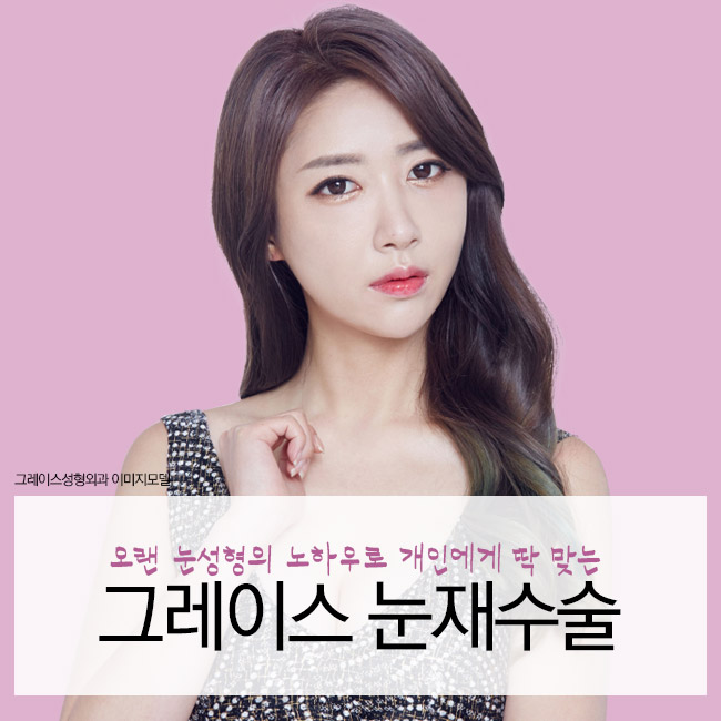눈재수술가격을 알아본다면 관련 이미지 3
