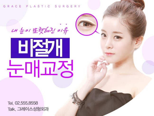 그레이스성형외과에서 더블락비절개눈매교정으로 또렷하게! 관련 이미지 3