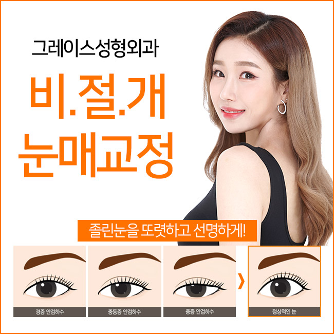 비절개눈매교정가격 만족스러운 후기까지 관련 이미지 3