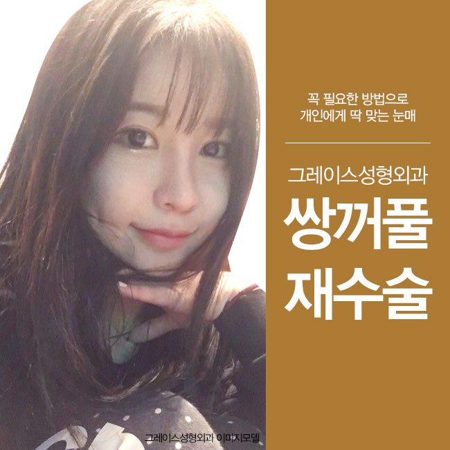 그레이스성형외과 최문섭원장님이 직접 집도하는 눈재수술 관련 이미지 4