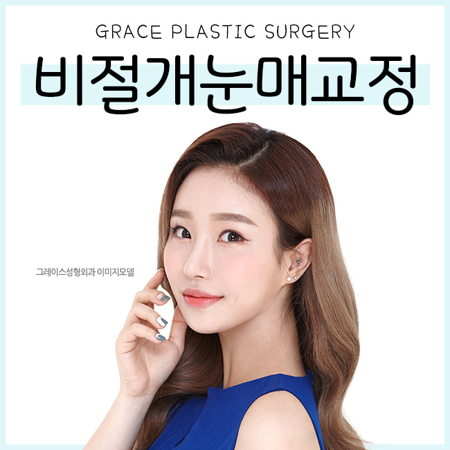 비절개눈매교정으로 또렷한 인상을 갖다! 관련 이미지 1