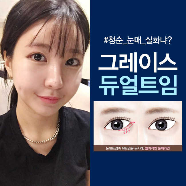 리얼 듀얼트임 후기, 신사역 그레이스성형외과에서 알아보자! 관련 이미지 2