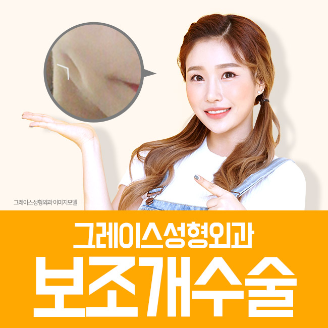 보조개수술 합리적인 가격과 매력적인 후기까지 관련 이미지 3