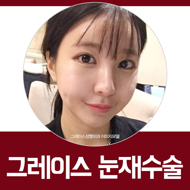 눈재수술성형외과를 알아보신다면? 그래! 그레이스성형외과 관련 이미지 2