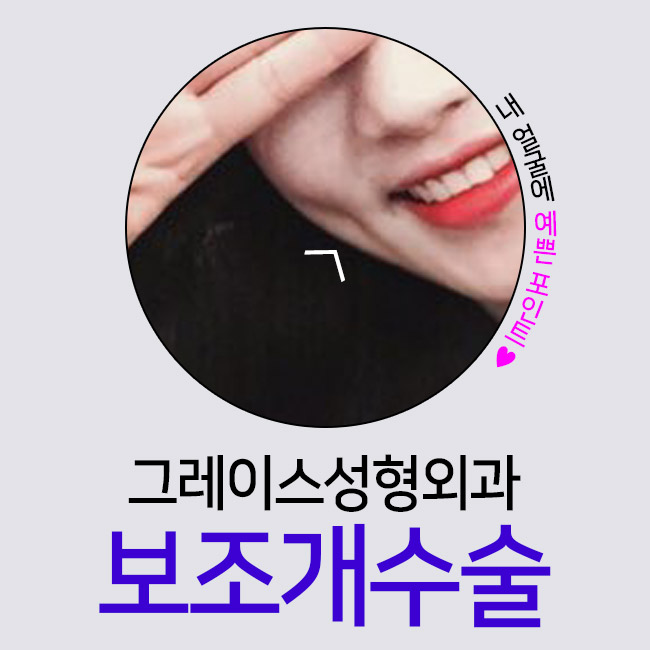 예쁜 포인트♡ 보조개수술후기를 알아보신다면? 관련 이미지 1
