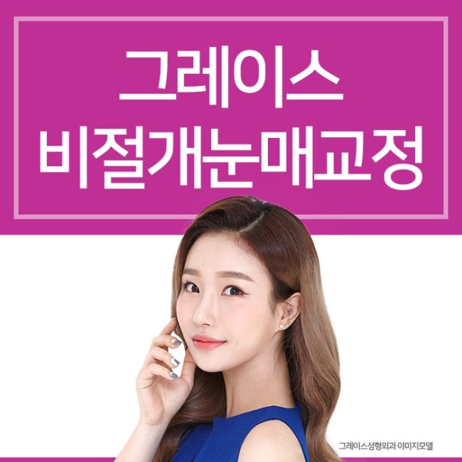 비절개눈매교정가격 또렷하고 자연스러운 눈매 관련 이미지 5