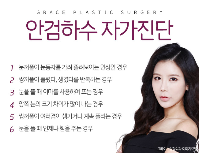 더블락 비절개눈매교정은 눈매교정잘하는곳, 그레이스성형외과에서 관련 이미지 2