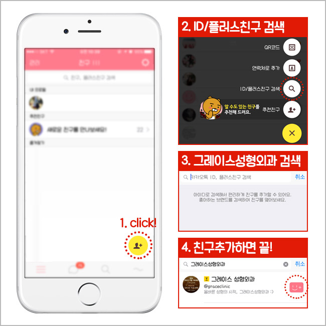 모티바가슴성형, 그레이스성형외과 최문섭 원장 관련 이미지 5