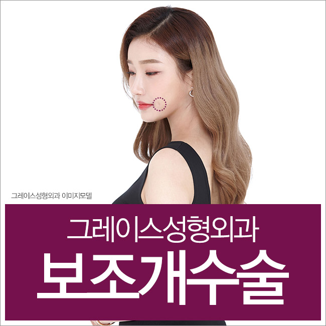 예쁜 포인트를 주는 보조개수술비용을 알아본다면 관련 이미지 5