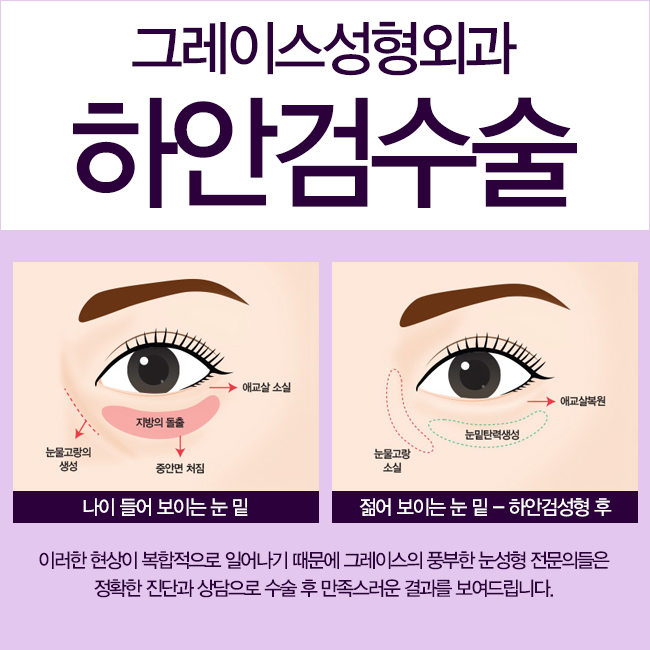 하안검수술후기로 부모님의 젊음을 찾아드리자! 관련 이미지 3