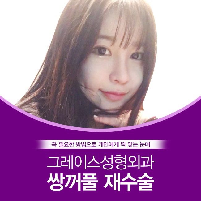 쌍꺼풀재수술 잘하는 병원은 그레이스성형외과 관련 이미지 4