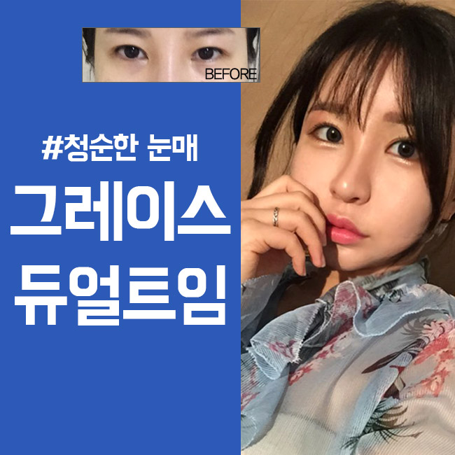 청순한 이미지를 원한다면 듀얼트임후기 정답! 관련 이미지 4