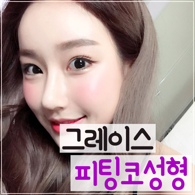 그레이스성형외과 최문섭원장님과 김윤호원장님이 집도하는 피팅코성형 관련 이미지 3