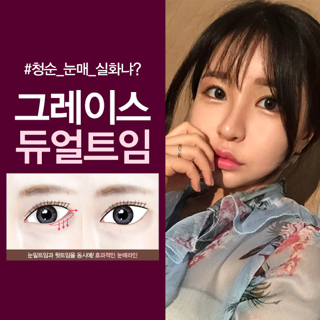 선하고 예쁜 눈매로 이미지 변신! 그레이스성형외과 듀얼트임 관련 이미지 1
