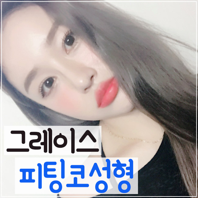 세련된 라인과 자연스러운 움직임을 모두 갖다! 그레이스성형외과 피팅코성형 관련 이미지 1