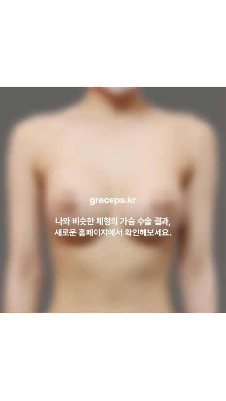 How Can Breast Augmentation Surgery Pain and Side Effects Be Reduced? image 8
