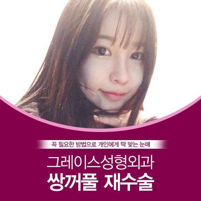 눈재수술하면 바로 이곳! 그레이스성형외과 관련 이미지 5